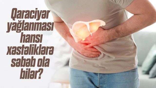 Videonun örtük şəkli: Qaraciyər yağlanması hansı xəstəliklərə səbəb ola bilər?