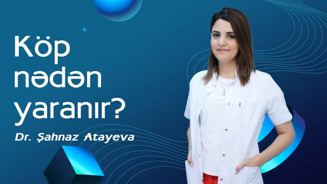 Videonun örtük şəkli: Köp nədən yaranır?